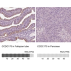 Anti-CCDC170 Antibody