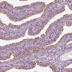 Immunohistochemical staining of human fallopian tube shows strong positivity in cilia in glandular cells.