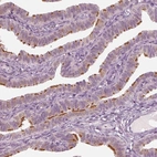 Immunohistochemical staining of human fallopian tube shows strong positivity in cilia in glandular cells.