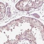 Immunohistochemical staining of human testis shows moderate cytoplasmic positivity in spermatogonia.