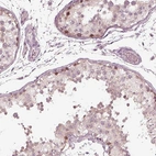Immunohistochemical staining of human testis shows moderate cytoplasmic positivity in spermatogonia.