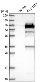 Anti-CCDC170 Antibody