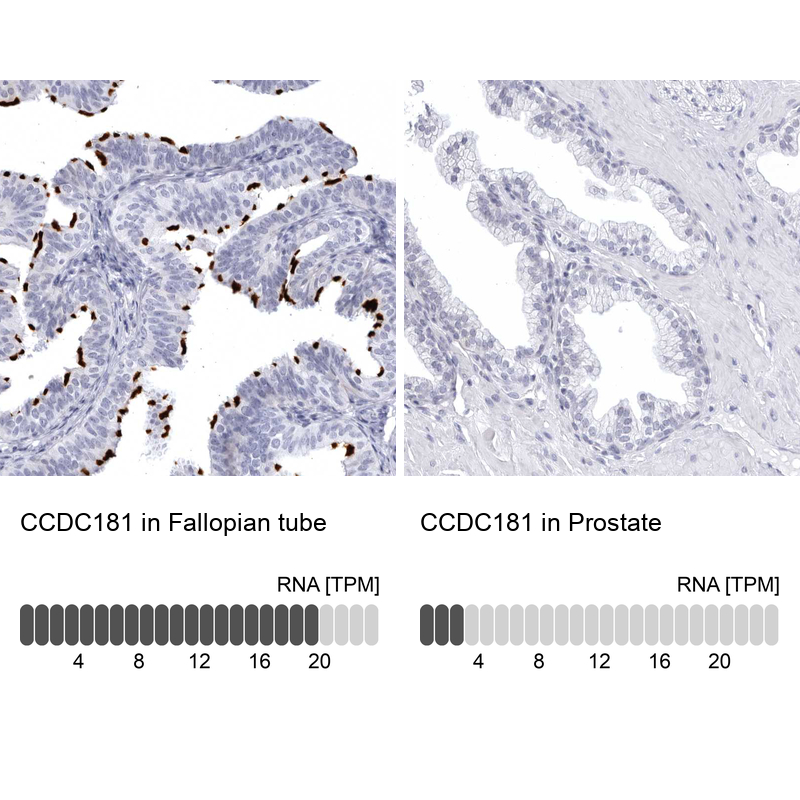 Anti-CCDC181 Antibody