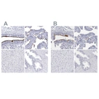 Immunohistochemical staining of human bronchus, fallopian tube, liver and prostate using Anti-CCDC181 antibody HPA027189 (A) shows similar protein distribution across tissues to independent antibody HPA027275 (B).