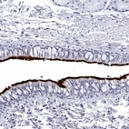 Immunohistochemical staining of human bronchus shows strong positivity in respiratory epithelial cells.
