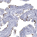 Immunohistochemical staining of human Fallopian tube shows strong positivity in cilia in glandular cells.