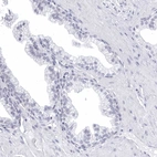 Immunohistochemical staining of human prostate shows no positivity in glandular cells as expected.