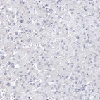 Immunohistochemical staining of human liver shows no positivity in hepatocytes as expected.