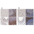Immunohistochemical staining of human cerebral cortex, lymph node, testis and tonsil using Anti-GIMAP4 antibody HPA027198 (A) shows similar protein distribution across tissues to independent antibody HPA019135 (B).