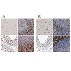 Immunohistochemical staining of human cerebral cortex, lymph node, testis and tonsil using Anti-GIMAP4 antibody HPA027198 (A) shows similar protein distribution across tissues to independent antibody HPA019135 (B).
