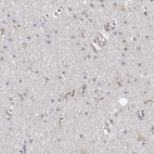 Immunohistochemical staining of human cerebral cortex shows low expression as expected.