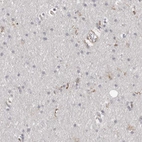 Immunohistochemical staining of human cerebral cortex shows low expression as expected.