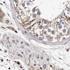 Immunohistochemical staining of human testis using Anti-GIMAP4 antibody HPA027198.