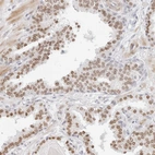 Immunohistochemical staining of human prostate shows moderate nuclear positivity in glandular cells.