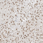 Immunohistochemical staining of human liver shows moderate nuclear positivity in hepatocytes.