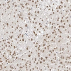Immunohistochemical staining of human liver shows moderate nuclear positivity in hepatocytes.