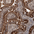 Anti-MRPS28 Antibody
