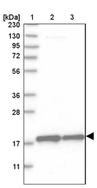 Lane 1: Marker [kDa] 230, 130, 95, 72, 56, 36, 28, 17, 11_br/_Lane 2: Human cell line RT-4_br/_Lane 3: Human cell line U-251MG sp