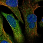 Immunofluorescent staining of human cell line U-2 OS shows localization to cytosol.
