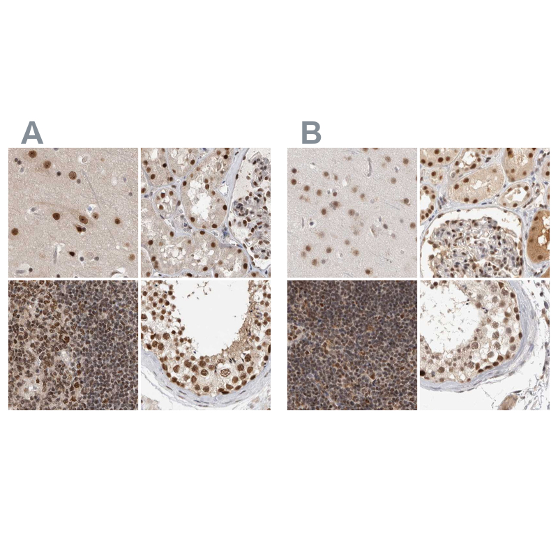 Anti-ZNF830 Antibody