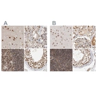 Anti-ZNF830 Antibody