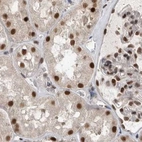 Immunohistochemical staining of human kidney using Anti-ZNF830 antibody HPA027211.