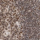 Immunohistochemical staining of human lymph node using Anti-ZNF830 antibody HPA027211.