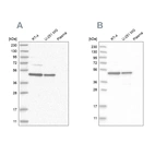 Western blot analysis using Anti-ZNF830 antibody HPA027211 (A) shows similar pattern to independent antibody HPA024754 (B).