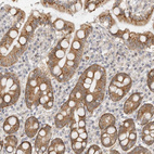 Anti-GGT6 Antibody