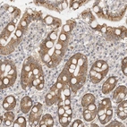 Anti-GGT6 Antibody