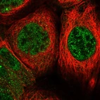 Immunofluorescent staining of human cell line A-431 shows localization to nucleoplasm.
