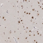 Anti-CXorf23 Antibody