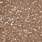 Anti-DCAF8 Antibody