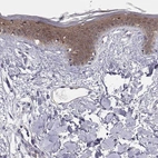 Immunohistochemical staining of human skin shows high expression.