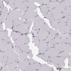 Immunohistochemical staining of human skeletal muscle shows low expression as expected.