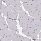 Immunohistochemical staining of human skeletal muscle shows low expression as expected.
