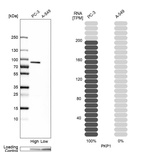 Western blot analysis in human cell lines PC-3 and A-549 using Anti-PKP1 antibody. Corresponding PKP1 RNA-seq data are presented for the same cell lines. Loading control: Anti-PPIB.