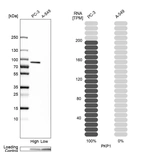 Western blot analysis in human cell lines PC-3 and A-549 using Anti-PKP1 antibody. Corresponding PKP1 RNA-seq data are presented for the same cell lines. Loading control: Anti-PPIB.