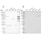 Western blot analysis using Anti-PKP1 antibody HPA027221 (A) shows similar pattern to independent antibody HPA027589 (B).