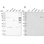 Western blot analysis using Anti-PKP1 antibody HPA027221 (A) shows similar pattern to independent antibody HPA027589 (B).