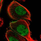 Immunofluorescent staining of human cell line PC-3 shows localization to nucleoplasm & plasma membrane.