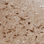 Anti-STXBP3 Antibody