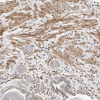 Immunohistochemical staining of human prostate shows moderate cytoplasmic positivity in smooth muscle cells.