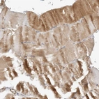 Immunohistochemical staining of human skeletal muscle shows moderate cytoplasmic positivity in myocytes.