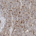 Immunohistochemical staining of human pancreas shows strong membranous positivity in exocrine glandular cells.