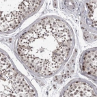 Immunohistochemical staining of human testis shows moderate nuclear positivity in cells in seminiferous ducts.