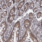Immunohistochemical staining of human duodenum shows moderate nuclear and cytoplasmic positivity in glandular cells.