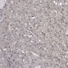 Immunohistochemical staining of human liver shows no nuclear positivity in hepatocytes as expected.