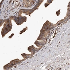 Immunohistochemical staining of human prostate shows moderate membranous and cytoplasmic positivity in glandular cells.