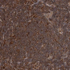 Immunohistochemical staining of human lymph node shows strong membranous positivity in non-germinal center cells.